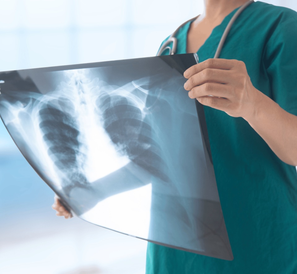 Labwork & Xrays in Conway